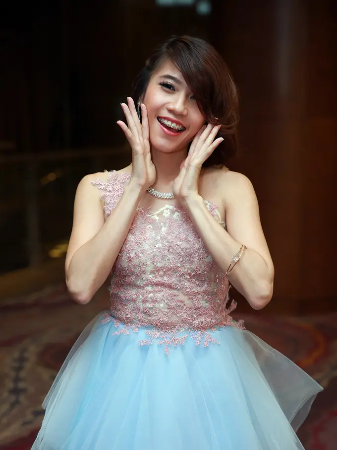 [Bintang] Gigi eks Cherrybelle
