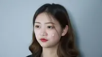 Stress Breakout Bikin Jerawat Bermunculan, Ini Cara Mengatasinya