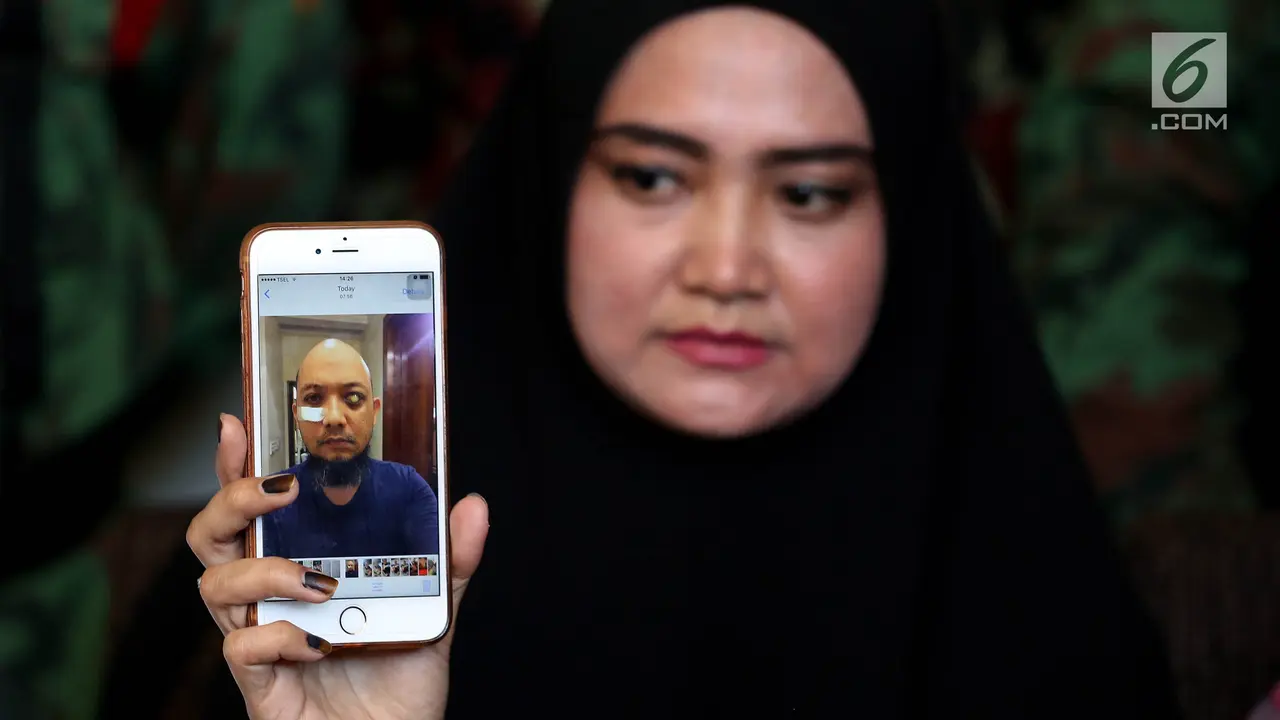 Minta Usut Tuntas Kasus Penyiraman, Istri Novel Baswedan Beri Keterangan Pers 