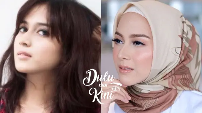 Dulu dan Kini: Transformasi Kecantikan Nina Zatulini yang Super Beda