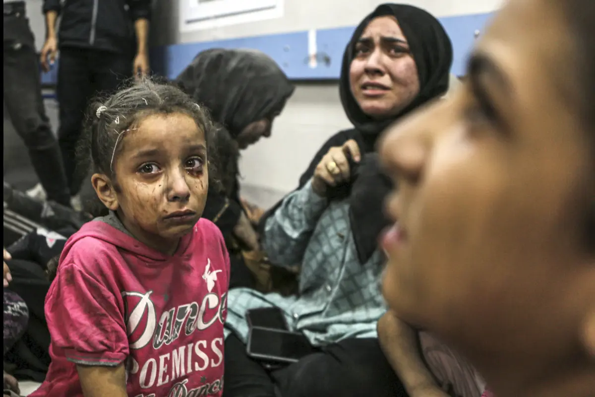 Seorang anak perempuan menjadi korban serangan roket di RS Gaza, 17 Oktober 2023.