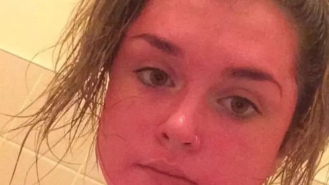 Salah Sabun, Kulit Tubuh Perempuan Ini Malah Berubah Jadi Pink