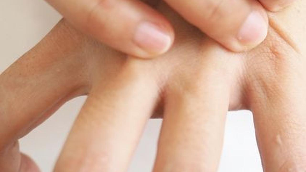 Awas! Ini Penyebab Stroke Menyerang Kaum Muda, Kenali Gejalanya