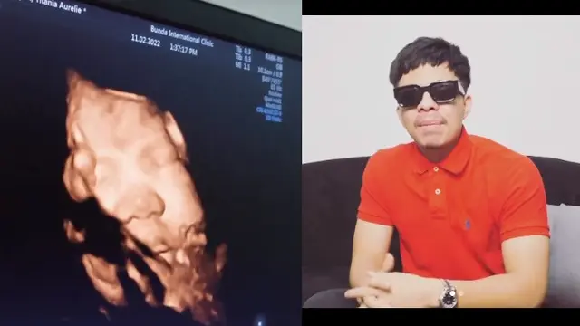 Aurel Hermansyah - Atta Halilintar (Foto: Instagram/@aurelie.hermansyah)