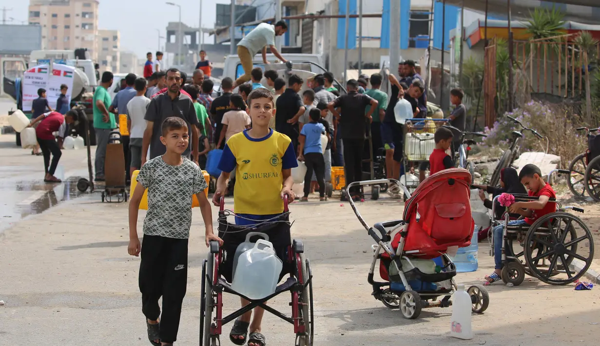 Peningkatan jumlah anak-anak yang mengalami kekurangan gizi seiring berlanjutnya pembatasan bantuan, pengungsian, dan serangan oleh Israel  di Jalur Gaza. (Eyad BABA/AFP)
