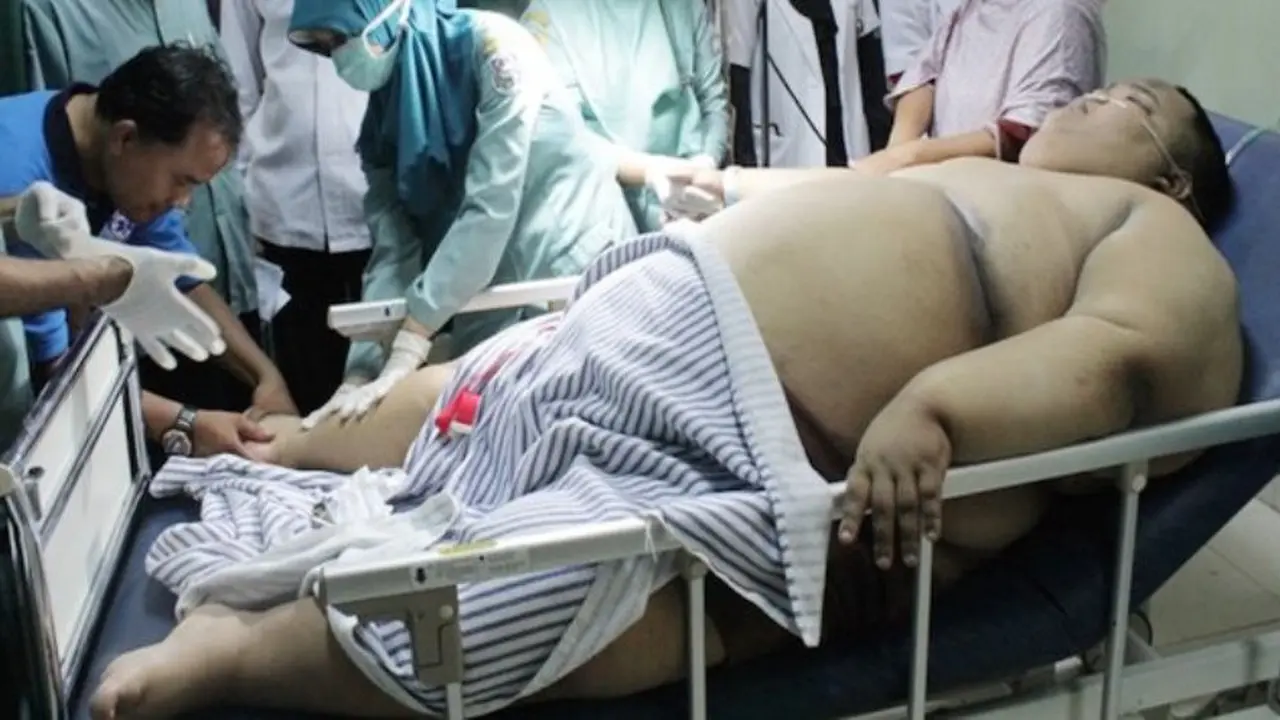 Wahid Zaenanda, Bocah 180 Kg Asal Tegal Meninggal Dunia 