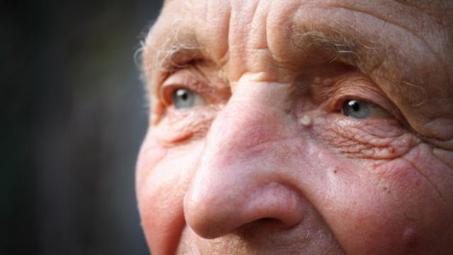 Ilustrasi mata katarak