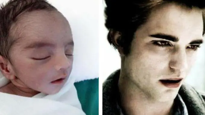 [Bintang] Punya Wajah Mirip Robert Pattinson, Bayi Ini Langsung Viral