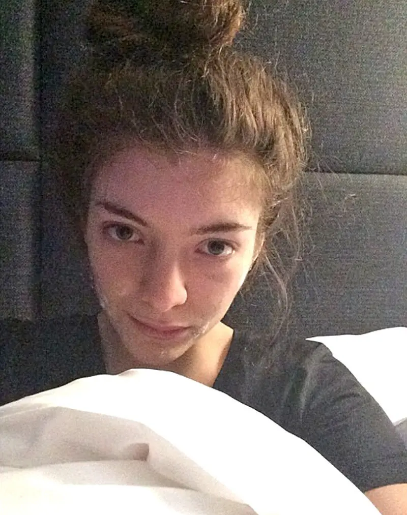 Lorde pun pernah pamer wajah jerawatan di Instagram, lho! (instagram/HollywoodLife)