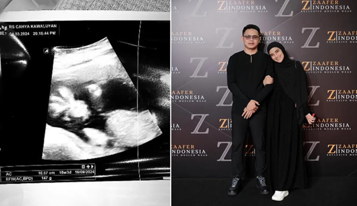 Potret hasil USG tersebut diambil pada 4 Maret 2024 malam, dengan keterangan bayi yang dikandung Nadya Mustika berusia 16 minggu lebih 3 hari. Mengetahui sang istri tengah hamil muda, Iqbal pun menjadi suami yang siap siaga menjaga Nadya. (Liputan6.com/IG/@iqbalfitrahr/@nadyamustikarahayu)