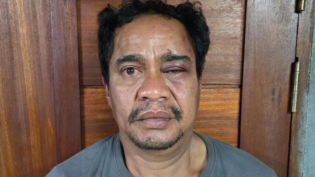 Tampang Boy Buronan Narkoba Jaringan Ko Erwin, Begini Kronologi Lengkap Penangkapannya