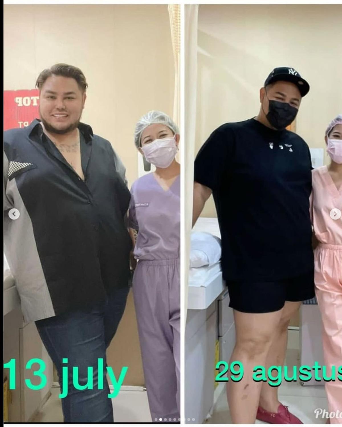 Potret Transformasi Ivan Gunawan Usai Jalani Diet, Banjir Pujian Netizen