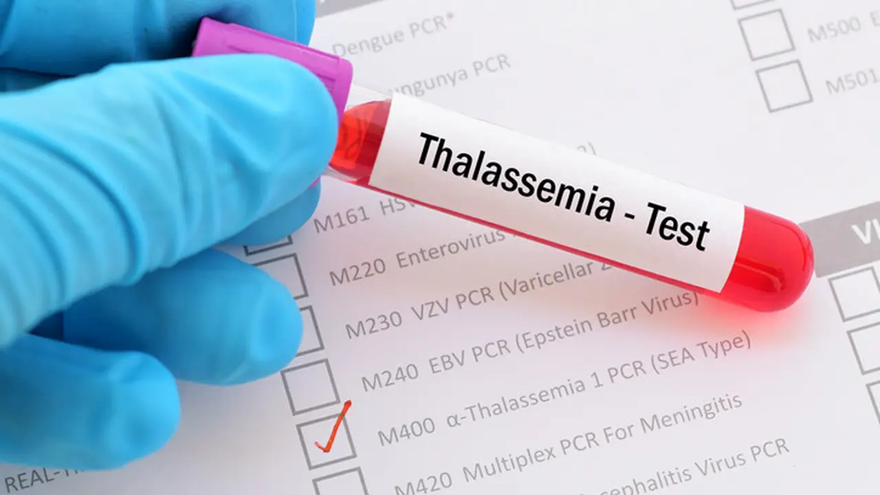 Penyakit Thalasemia