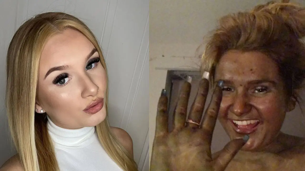 Salah Pakai Krim Tanning, Wanita Ini Terlihat Seperti Fiona ‘Shrek’