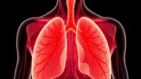 Dokter Beberkan Kondisi Paru Saat Terserang Pneumonia, Benarkah Ada Nanah di Dalamnya?