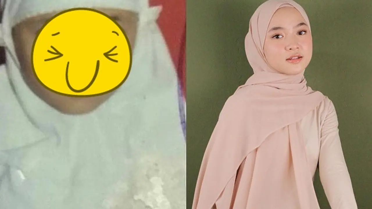 Unggah Foto Wajah Diperban dan Disebut Oplas, Ini 7 Potret Transformasi Nissa Sabyan