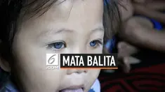 Amelia Anggraeni, balita perempuan berusia 2 tahun 5 bulan memiliki mata biru. Bahkan terkadang bola matanya dapat berubah keabu-abuan, cokelat hingga hitam. Fenomena ini menjadi perhatian seorang dokter mata rumah sakit
di Bandung.