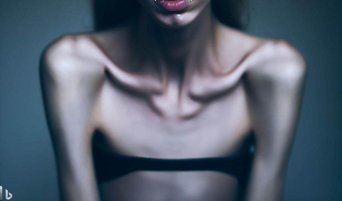 Muscle Dysmorphia