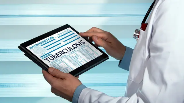 Cegah Penyebaran Tuberkulosis Lewat Vlog