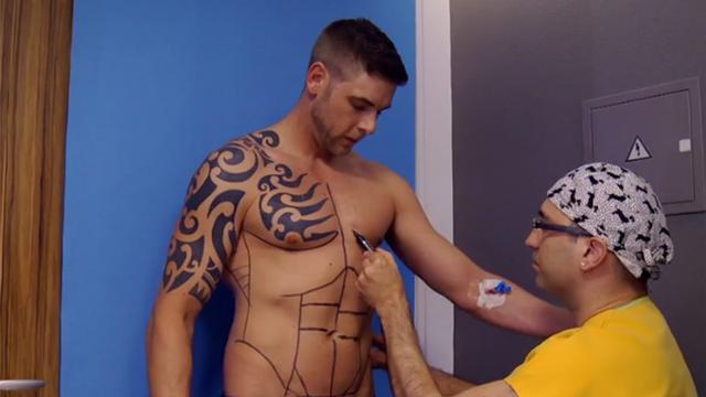 Malas Diet Pria Ini Pilih Operasi Agar Six Pack Health Liputan6 Com