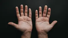 Tangan Sering Kesemutan? Bisa Jadi Ada Gangguan Saraf