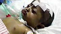 Kondisi Slamet Hadi Shahputra, bocah yang menjalani operasi cangkok hati. belum juga membaik. Infeksi di paru-paru dan saluran pernafasan Slamet kian meluas.