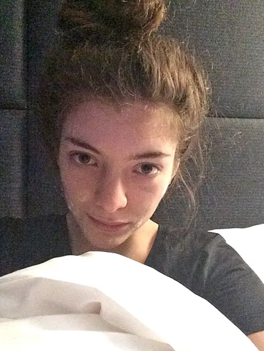 Lorde pun pernah pamer wajah jerawatan di Instagram, lho! (instagram/HollywoodLife)