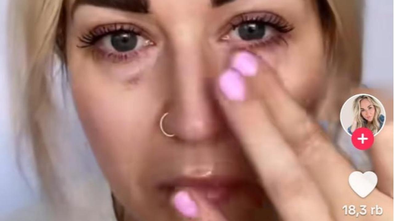 Moisturizing